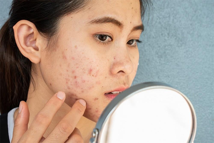 How to prevent clogged pores all summer long.