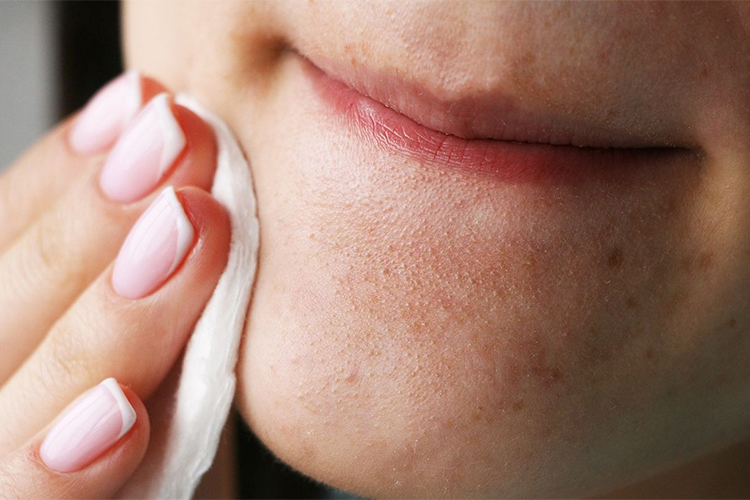 How to prevent clogged pores all summer long.